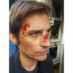 Prothèses Transfert - Coups Et Blessures